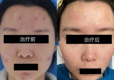 Scutellaria Root Extract function Scutellaria Root Extract function